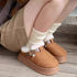 Fuzzy Buckle Platform Clogs